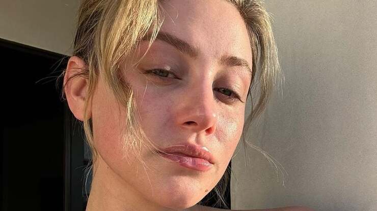 Lili Reinhart spricht offen über Akne und ihre Auswirkungen auf die Schauspielkarriere