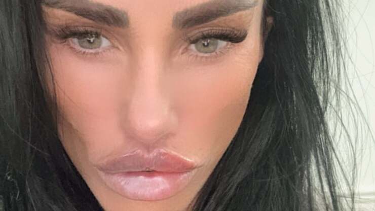 Katie Price kündigt dritte BBL-Operation an: Po-Pflege im XXL-Format geplant